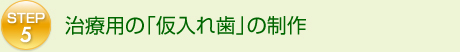 治療用の「仮入れ歯」の制作 